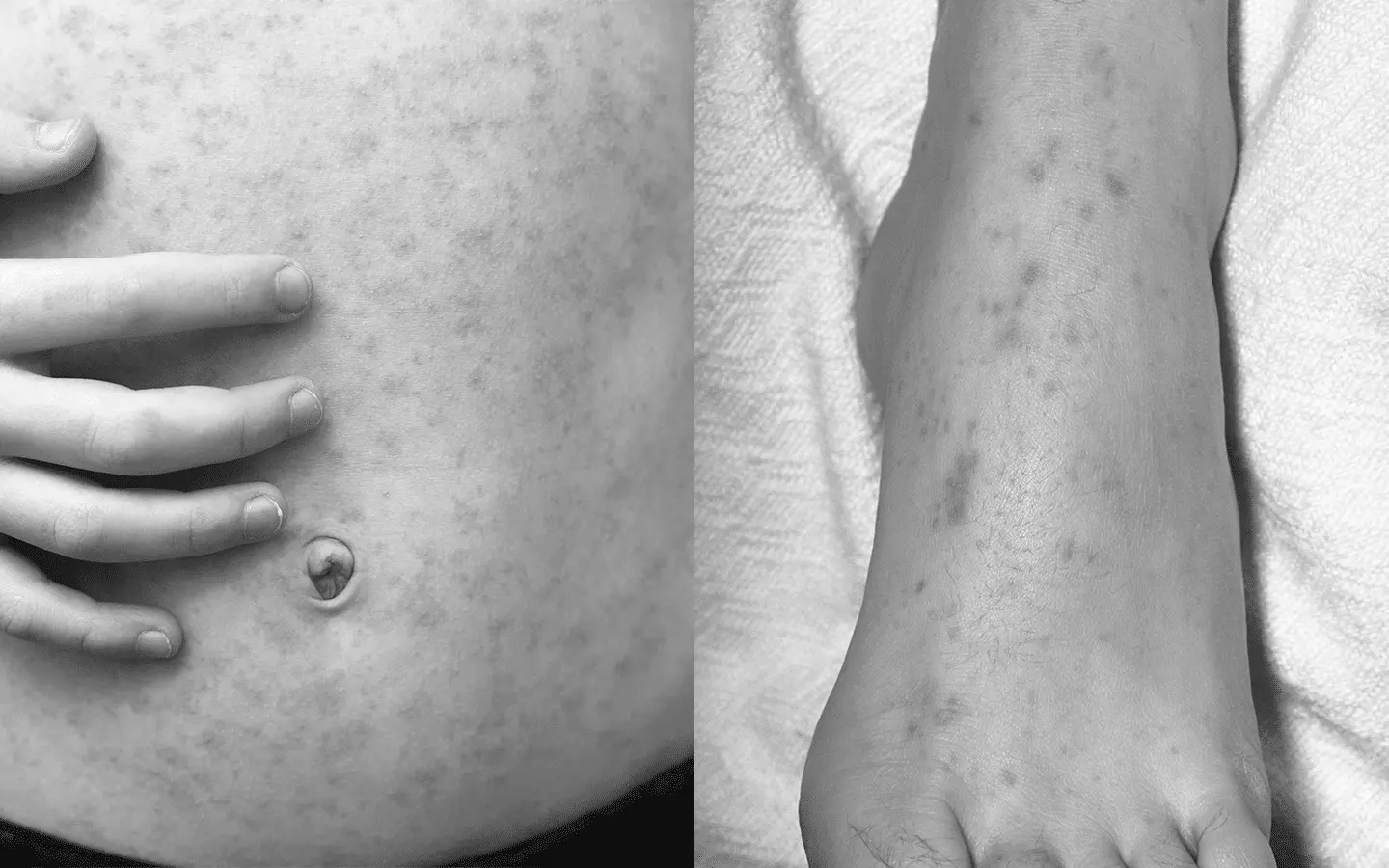 Best Itching & Rash Treatments