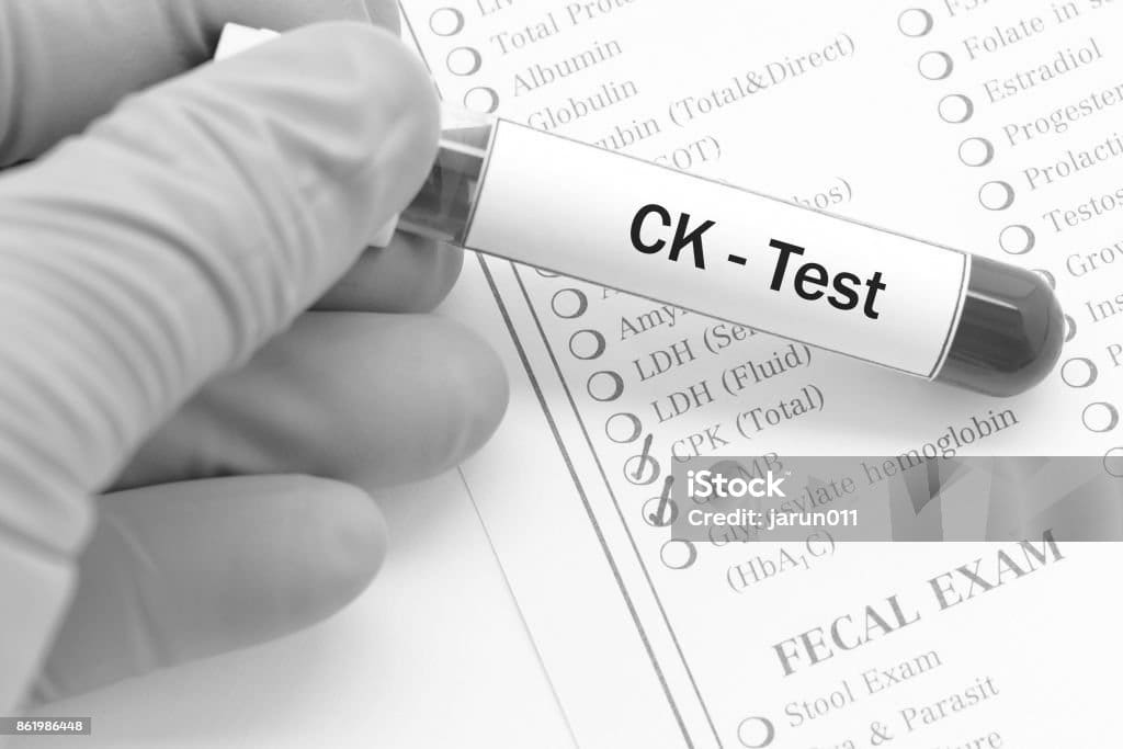 Creatine Kinase Test What You Need to Know